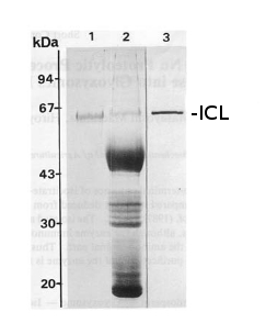 SDS-PAGE of isociatrate lyase (ICL)